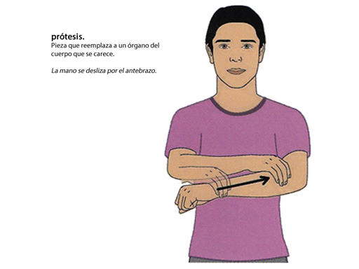 PRÓTESIS